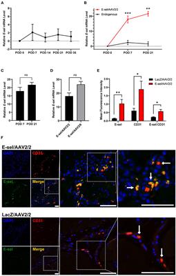 E-Selectin/AAV2/2 Gene Therapy Alters Angiogenesis and Inflammatory Gene Profiles in Mouse Gangrene Model
